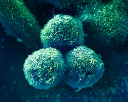 Immune system lymphocytes attack cancer cells, in an image provided by Merck.
