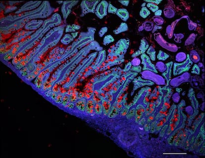An image of the small intestine.